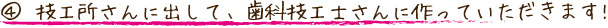 技工所さんに出して、歯科技工士さんに作っていただきます!